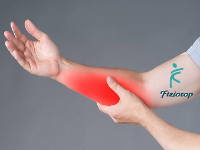 Fractura de radius