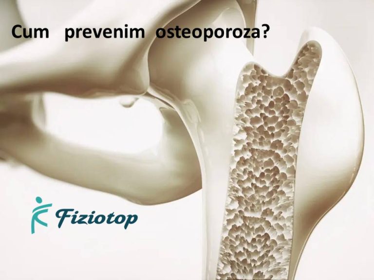Cum prevenim osteoporoza?